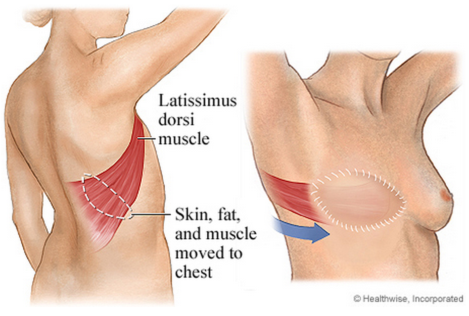 Latissimus Dorsi