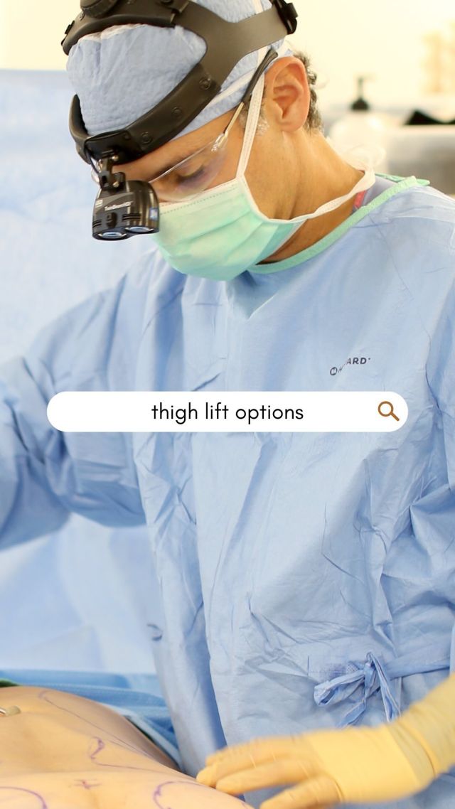 Thigh lift surgery reshapes the thighs by reducing excess skin and fat. This results in smoother skin and better-proportioned contours of the thighs and lower body.

Since there are different types of thigh lifts, our board-certified plastic surgeon will assess each patient during a consultation and create a surgical plan based on their needs and goals. 

Contact us at 310-784-0644 to schedule a consultation today!

#southbayplasticsurgeons #sbps #plasticsurgery #plasticsurgeon #southbay #thighlift #medialthighlift #losangelesplasticsurgery #losangelesplasticsurgeon