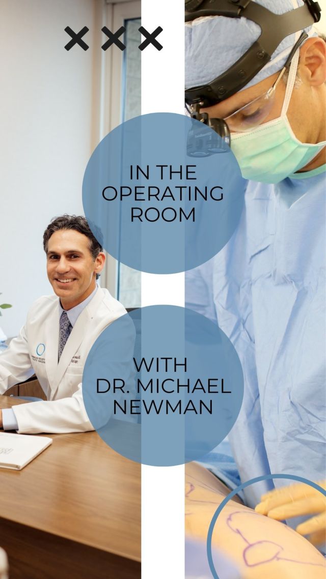 CAN I DOWNSIZE MY BREAST IMPLANTS? ABSOLUTELY!⁠
⁠
At South Bay Plastic Surgeons, we have five board-certified plastic surgeons who specialize in all kinds of breast surgery. An experienced plastic surgeon, can assist you in downsizing your breast implants without sacrificing the improved shape your implants have provided. With that being said, breast implant replacement isn’t always as simple as swapping out for a smaller size. A secondary procedure is always more challenging to perform than the initial procedure. At your consultation, our plastic surgeon and patient care coordinator will discuss options and create a customized surgical plant to help you achieve your goals.⁠
⁠
Are you interested in replacing your breast implants? Click the link in bio or call us at 310-784-0644 to schedule a consultation today!⁠
⁠
#breastaugmentation #breastimplants #breastsurgery #secondarybreastsurgery #breastlift #mastopexy #southbayplasticsurgeons #sbps #plasticsurgery #plasticsurgeon #losangelesplasticsurgery #losangelesplasticsurgeon #southbay