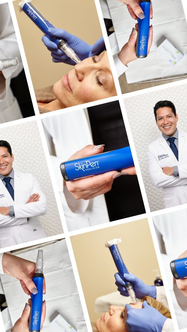 Follow along as Dr. Rendon has his 3rd PRP treatment for hair loss!⁠
⁠
Platelet-Rich Plasma (PRP) is a great treatment option for hair loss. Our blood is made of two main components: red blood cells and plasma. The plasma contains white blood cells and platelets, which are rich in growth factors. Growth factors can help stimulate the activity of the hair follicles and promote new hair growth. ⁠
⁠
Treatments are generally scheduled 4-6 weeks apart and the number of treatments needed varies. For best results, consistency is key!⁠
⁠
Are you interested in PRP for hair loss? Contact us at 310-784-0670 to schedule a consultation today!⁠
⁠
#PRP #PRPinjection #hairloss #spaatsouthbayplasticsurgeons #medspa #southbayplasticsurgeons #sbps #plasticsurgeon #plasticsurgery #hair