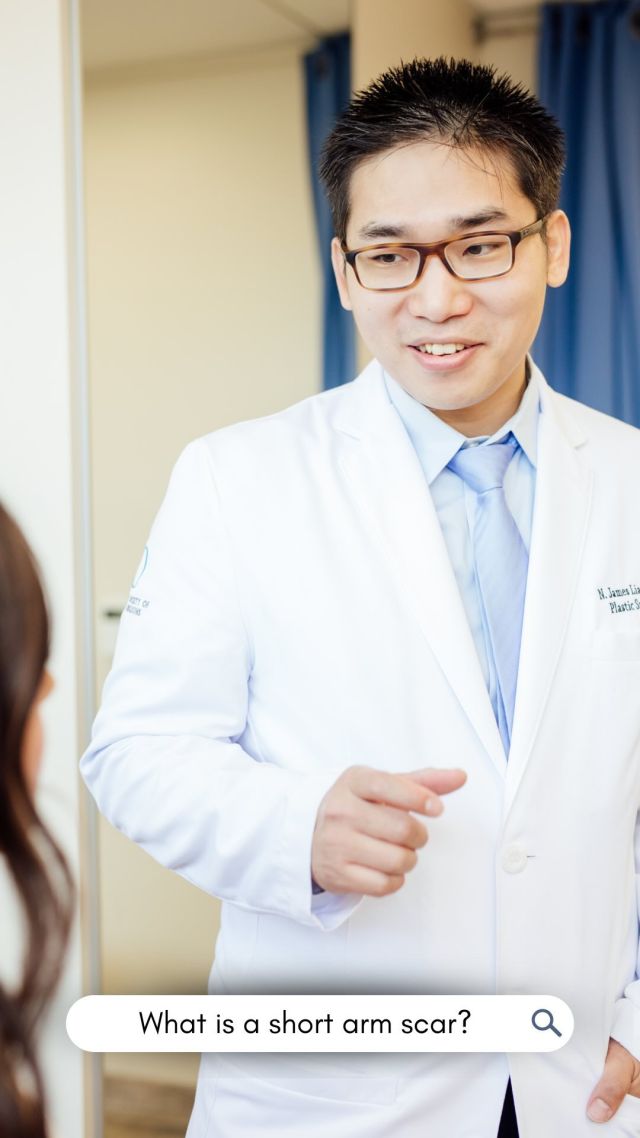 Say goodbye to loose arm skin and hello to confidence!  Our short scar brachioplasty is designed to minimize the appearance of scars and improve the contour of your arms. ⁠
⁠
A brachioplasty (AKA arm lift) removes excess arm skin and fat to reshape the arm leaving a slimmer and smoother contour. There are several versions of this procedure depending on the amount and location of the loose skin. Our board-certified plastic surgeons will work with you to create a customized surgical plan that will maximize results and minimize scars. ⁠
⁠
For this patient, Dr. Liang performed a short scar arm lift to address her concerns. The incision is significantly shorter than a traditional brachioplasty and is useful for patients who have minimal skin laxity.  Don’t let scars hold you back any longer – contact us today to learn more!⁠
⁠
Are you interested in an arm lift? Click the link in bio or call us at 310-784-0644 to schedule today!⁠
⁠
#southbayplasticsurgeons #sbps #armlift #brachioplasty #shortscararmlift #plasticsurgeon #losangelesplasticsurgery #losangelesplasticsurgeon #southbay #plasticsurgery #scars #scarremoval #cosmeticsurgery #beauty #confidence #shortarmscar #surgery #health #wellness #aesthetics #transformation #cosmeticprocedures #medical #selflove #selfcare #bodypositivity