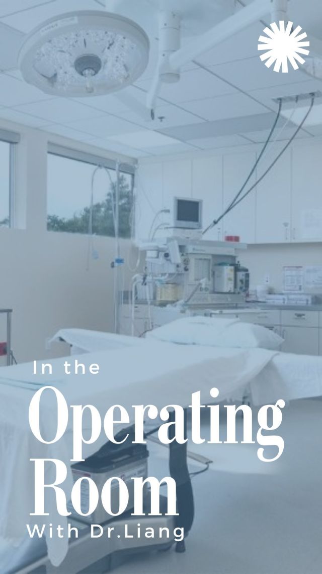Breast augmentation is the most performed plastic surgery procedure in America and has an extremely high patient satisfaction rate. This surgery is highly customizable and our board-certified plastic surgeons and experienced Patient Care Coordinator work with each of our patients to educate them and guide them through the process. ⁠
⁠
A few of the things to consider prior to having a breast augmentation are:⁠
⁠
Size: Breast implants do not come in cup sizes and instead come in cc’s. We assist patients in determining what volume would be best for their body by trying on breast implants in the office and utilizing @canfieldsci, a 3D imaging software that can simulate a patient’s result.⁠
⁠
Material: All breast implants have a silicone shell; fill options include saline, less cohesive silicone gel, and form stable silicone gel⁠
⁠
Style: Implants come in a variety of profiles/projections ⁠
⁠
Placement of Implant: An implant can be placed on top of the muscle, under the muscle, or dual plane. Our board-certified plastic surgeons always use a Keller Funnel when placing the implant employing a “”no touch”” technique⁠
⁠
Incision: Incisions are small and placed either along the areola, in the fold under the breast, or in the armpit⁠
⁠
Longevity: While implants are very durable, they are not a lifetime device so additional surgery in the future will be required⁠
⁠
Keller Funnel:  The Keller funnel is helpful for placing the implant into the chest pocket⁠
⁠
Are you interested in learning more about breast augmentation surgery? Click the link in bio or call us at 310-784-0644 to schedule a consultation today!⁠
⁠
⁠
⁠
⁠
⁠
⁠
#southbayplasticsurgeons #sbps #breastaugmentation
