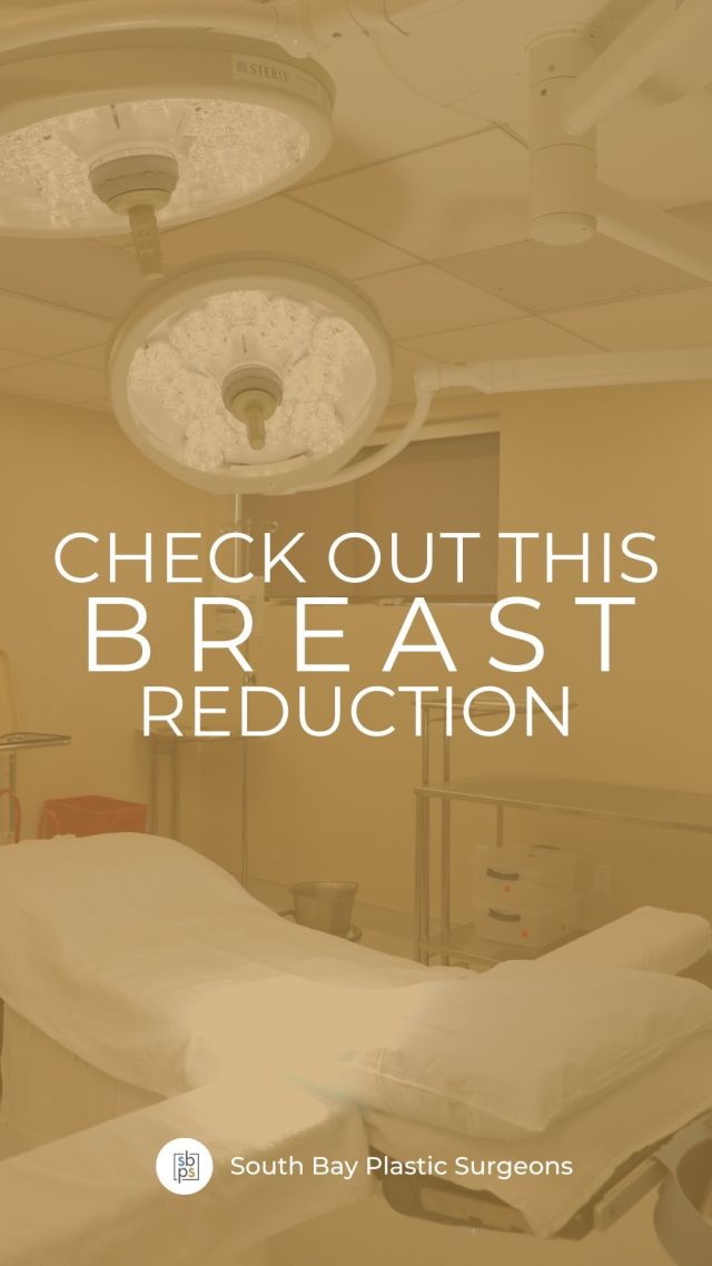 Breast reduction is a surgical procedure that removes excess breast tissue, fat, and skin to reduce the size and weight of the breasts. The procedure is most commonly performed on women with overly large breasts that cause discomfort, back pain, neck pain, shoulder pain, and skin irritation.⁠
⁠
During breast reduction surgery, not only is the breast volume reduced, the remaining tissue is reshaped and lifted to create a more proportional and aesthetically pleasing breast contour. The areola can also be resized and repositioned.⁠
⁠
Our breast reduction patients always say their only regret is that they wish they had had the surgery sooner! Are you interested in a breast reduction? Click the link in bio or call us at 310-784-0644 to schedule a consultation today!⁠
⁠
⁠
⁠
⁠
⁠
⁠
⁠
⁠
⁠
⁠
⁠
⁠
#southbayplasticsurgeons #sbps #southbay