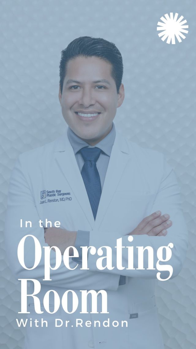 Breast implants are not designed to last forever. At South Bay Plastic Surgeons, we advise our patients that most women will want a secondary breast surgery within 10-20 years of their initial implantation. There are many reasons why a woman may choose to have her implants removed and/or replaced. One of the most common reasons is implant rupture. ⁠
⁠
While all breast implants have a silicone shell, what the implant is filled with can vary. Saline implants are filled with water and therefore will go flat when they rupture. Silicone implants are filled with a cohesive gel so often times patients do not notice a change in their breasts if they have a ruptured implant. This is known as “silent rupture” because it does not cause any signs or symptoms. For silicone implants, the FDA recommends periodic screening with MRI to detect a rupture.⁠
⁠
During your consultation, our surgeons will work to create a customized surgical plan to meet your goals. We specialize in all types of breast surgery and offer cutting edge techniques allowing us to deliver beautiful and natural results for even the most complex cases.⁠
⁠
Are you interested in breast surgery? Click the link in bio or call us at 310-784-0644 to schedule today!⁠
⁠
#breastaugmentation #southbay #southbayplasticsurgeons #sbps