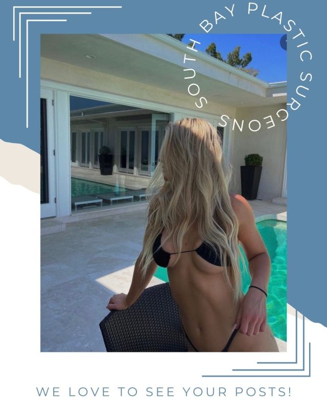 Picture-Perfect Confidence! 📸✨ A big shoutout to our incredible patient for sharing this stunning post-surgical selfie with us! 🙌💕 This 23-year old woman wanted larger, fuller breasts so @drliangplasticsurgeon performed a bilateral breast augmentation with Allergan 385cc high profile implants @natrellebreastaugmentation⁠
⁠
At South Bay Plastic Surgeons, we love celebrating our patient's success stories! Have you had a life-changing experience with us? Please tag us in your selfies! Share your story, spread the love, and let's celebrate your confidence together. 🌟💫 #breastaugmentation #sbps #southbayplasticsurgeons