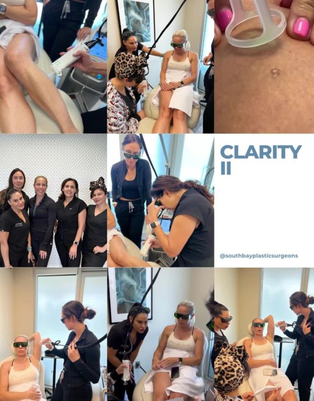 At The Spa at South Bay Plastic Surgeons, we are proud to be at the forefront of laser technology and offer the Clarity II to our patients!⁠
⁠
The Clarity II laser from Lutronic is designed to stand out. The IntelliTrak technology makes it easier to treat larger areas in less time. It also has two distinct wavelengths that make this device capable of treating a wide range of skin colors and tones. ⁠
⁠
Step into the future of hair removal with our providers! Call us at 310-784-0670 to schedule today!⁠
⁠
#laserhairremoval #sbps #southbayplasticsurgeons